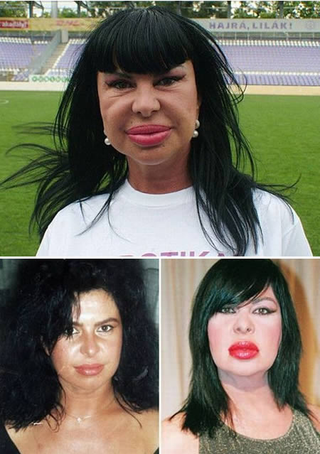 12 Weirdiest Plastic Surgery Makeovers