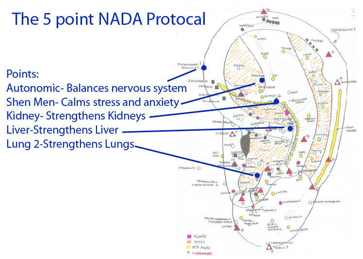Acuthink Acupuncture For Smoking Cessation