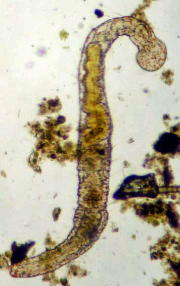 Beyond the Human Eye: A tiny aquatic worm that clones itself