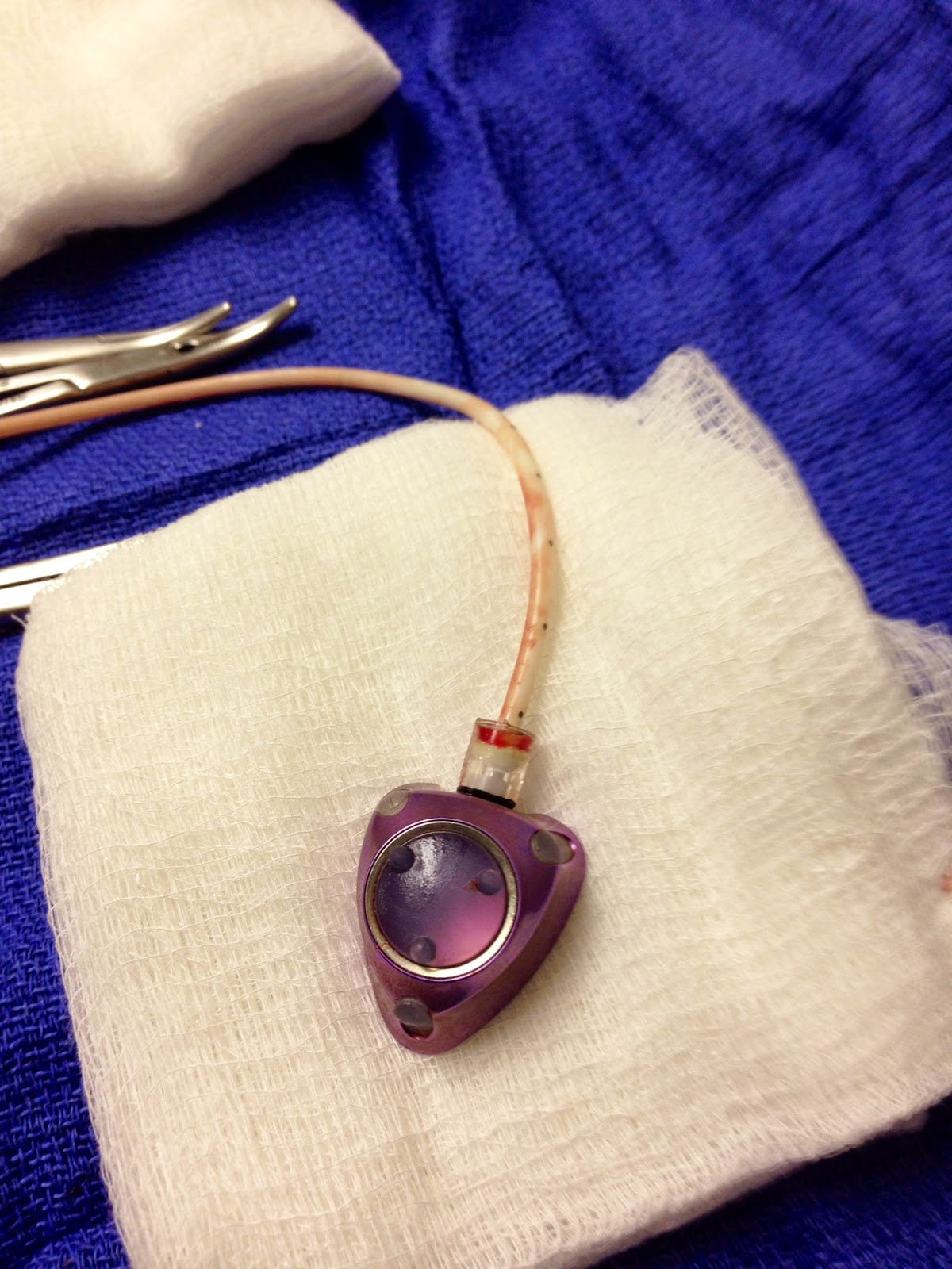 LIVING positively with triple negative breast cancer my unexpected