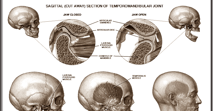 Tmj and sinusitis