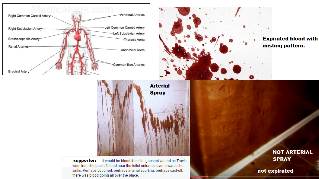 Jodi Arias Trial Truth Debunking the Bathroom Blood Spatter Claim