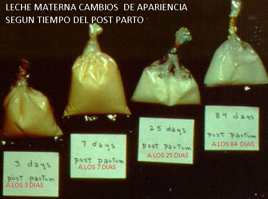 Enfermeras peru: enfermeras enfermeros enfermerÃa web: leche ...