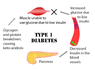 http://candidarticle.blogspot.com/2015/08/autoimmune-disease.html#