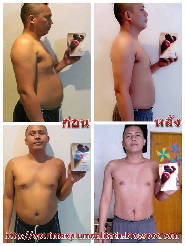 Optrimax Plum Delite TH ภาพก่อนและหลังทานพลัมดีไลท์ 5