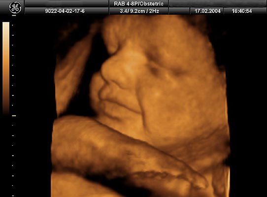 La Gestacion de un Bebe en imagenes La Gestacion de un Bebe en imagenes