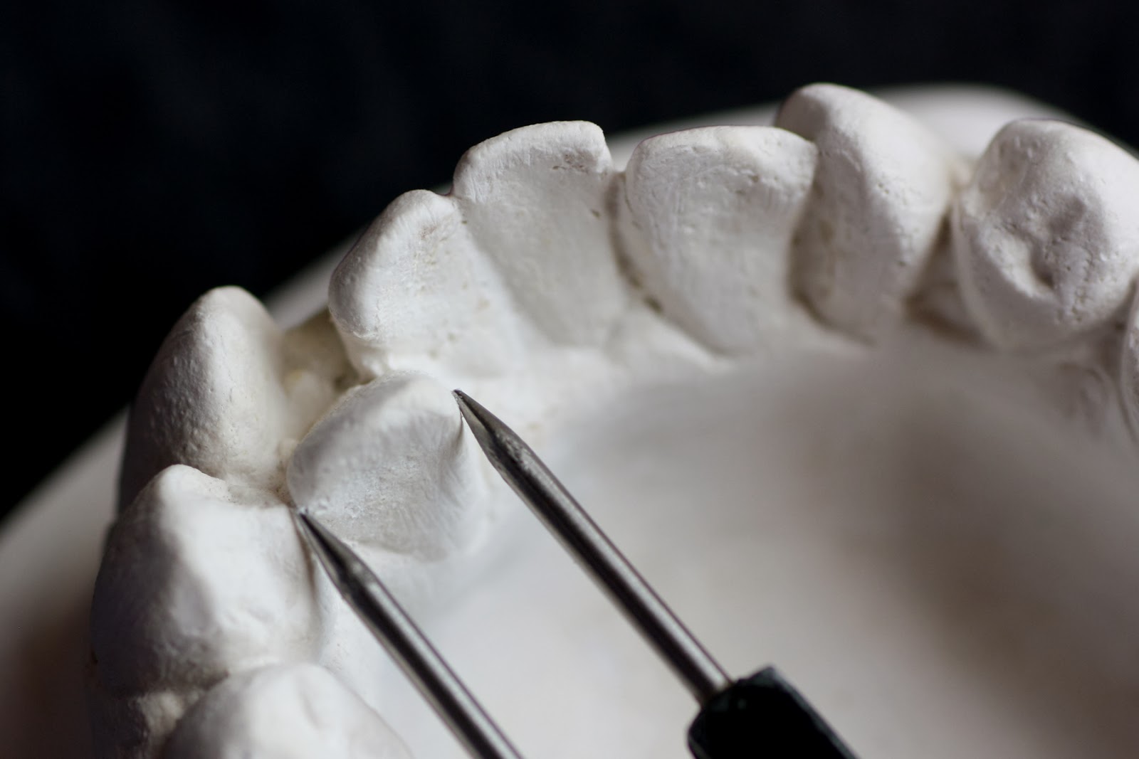 Orthodontics UG Model Analysis Tooth width measurement