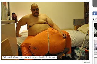Homem passa por cirurgia para reduzir testículos que pesam 63 kg