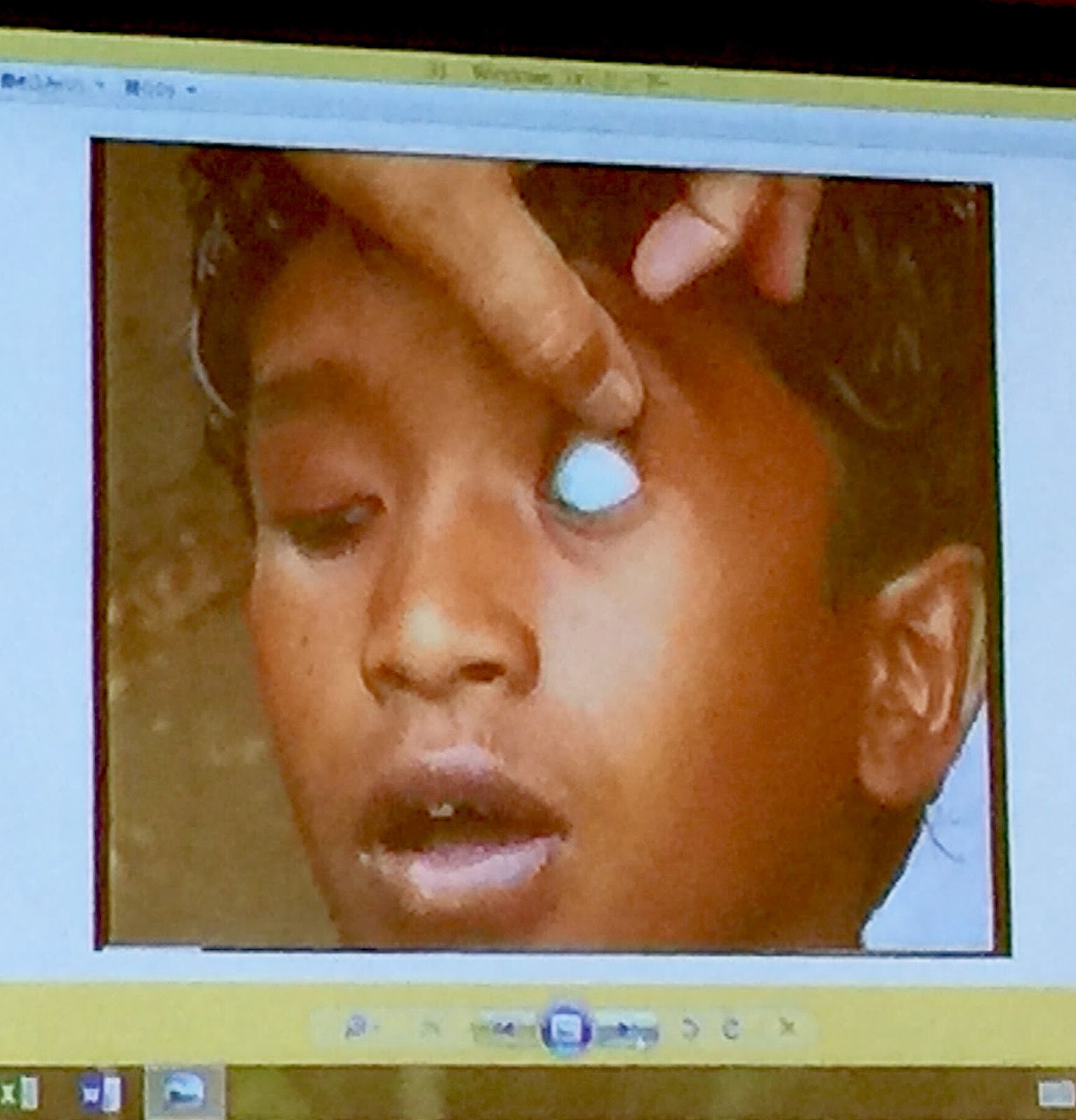 Hiroshima Mon Amour For A Nuclear Free Future World Nuclear