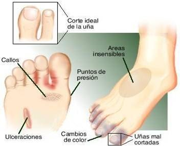 El ungüento para el tratamiento de la eccema de la oreja