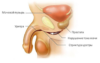 мужская уретра 