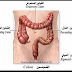 علاج القولون 100% - اعراض القولون