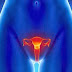 Câncer de ovário: ultrassom é grande aliado do diagnóstico precoce