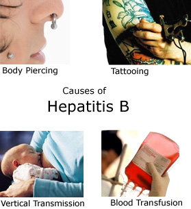 All About Hepatits B: Transmission of Hepatitis B