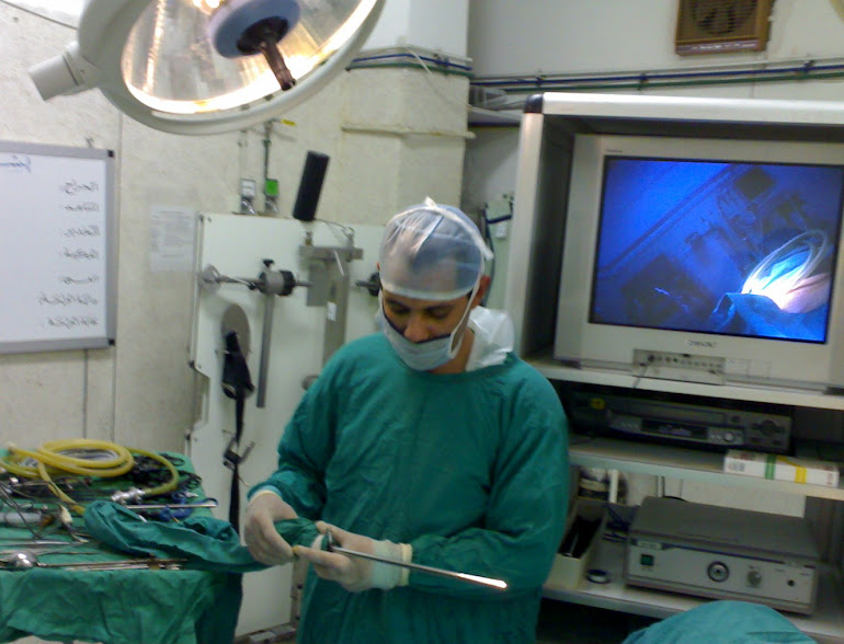 Laparoscopy - Dr. Alaa Mosbah