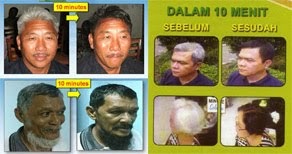 Jual Obat Uban Alami