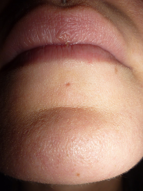 The medusa (upper lip) piercing is one of the few piercings I have title=