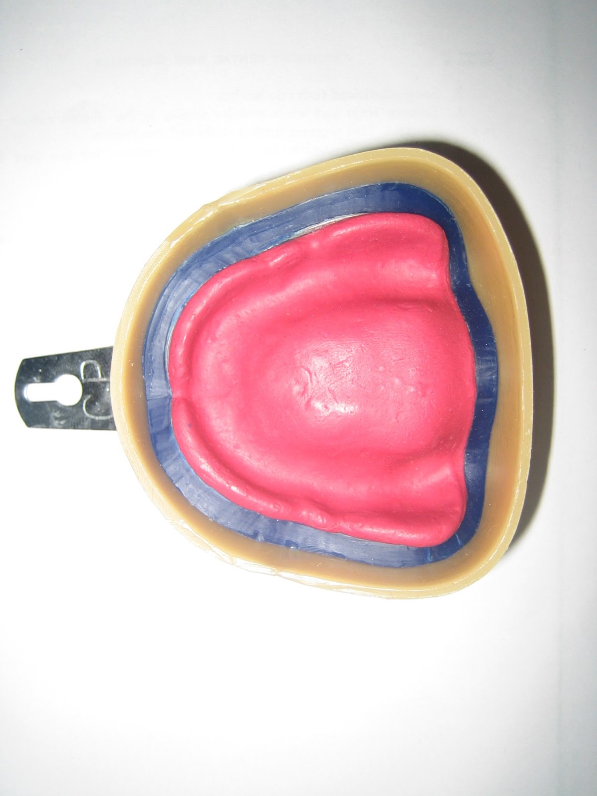 Step by step Guide for Understanding the Prosthodontics Beading and