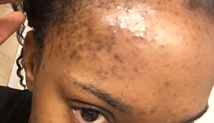 Synthetic Hair Almost Ruined My Skincare Blogger Life Skin