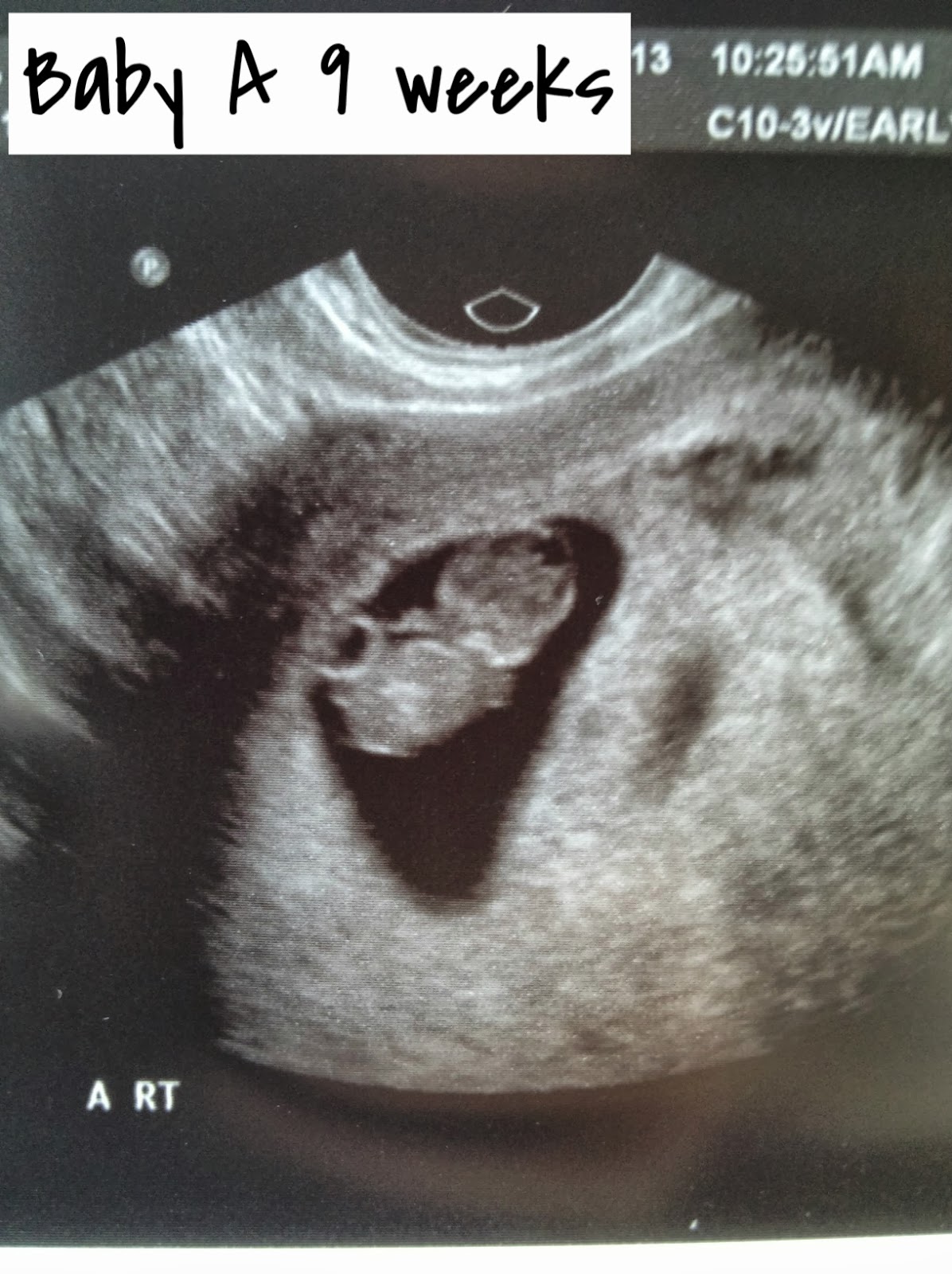 A baby for you: 9 Weeks
