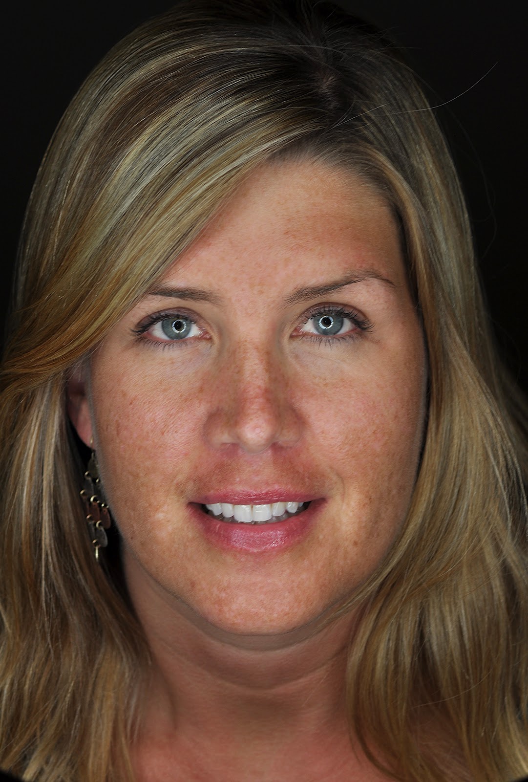 Dental Photography Pearls For Better Images Instantly A New Flash