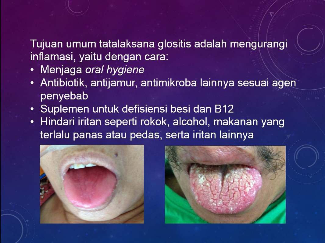 Doctor S Blog Pelengkap Kuliah Blok Gastroenterologi 24 Mei 2014 Bagian 1