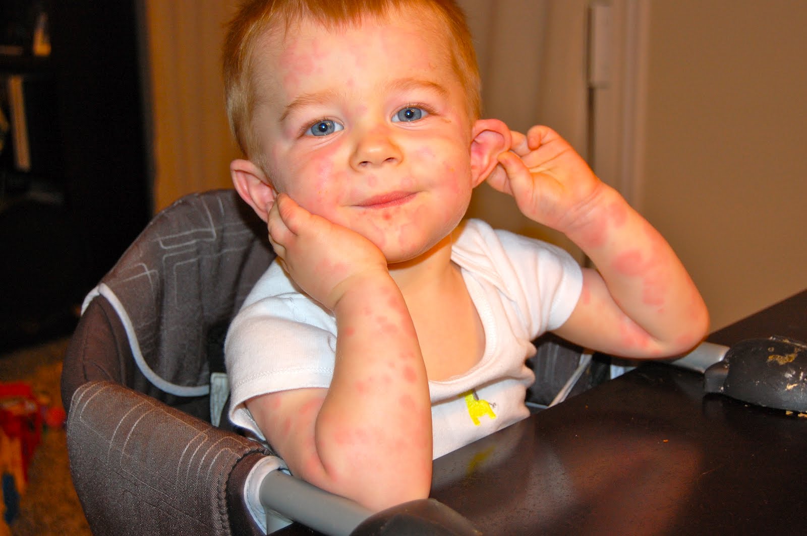 The Pattersons Deacon's weird disease.