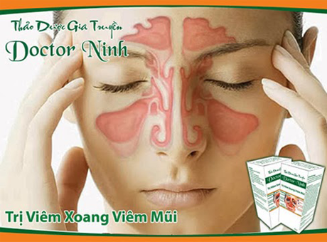 Thuoc tri viem xoang doctor ninh