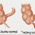 Obat Herbal Radang Usus Buntu (Koloklin Capsule ) | Obat Radang Usus (Appendicitis) thumbnail