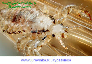 Вши на голове фото Vshi na golove foto
