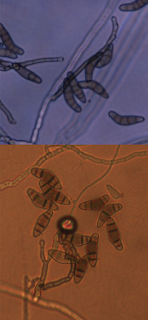 Curvularia spores Image of Curvularia spores