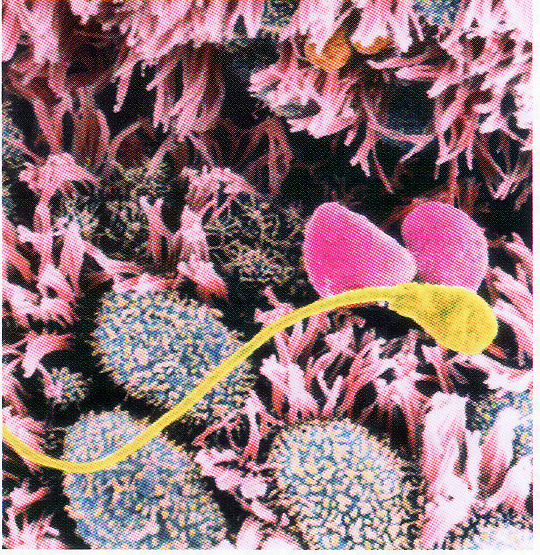 'Rianti Marsita' 'Kehamilan'