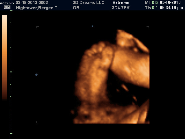 Bergen Taylor Hightower A Blessing