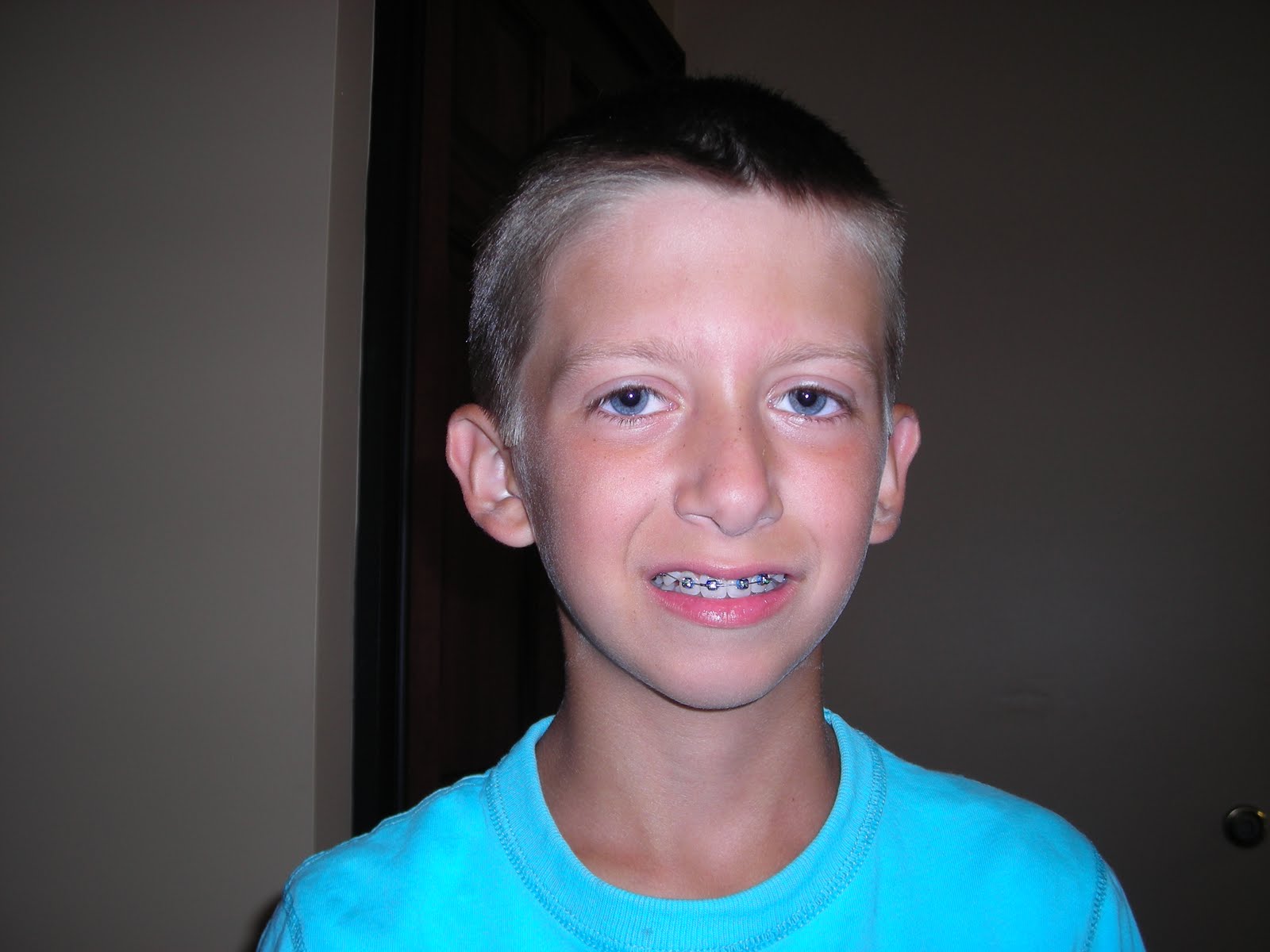 Serenity Installing the Dreaded Braces