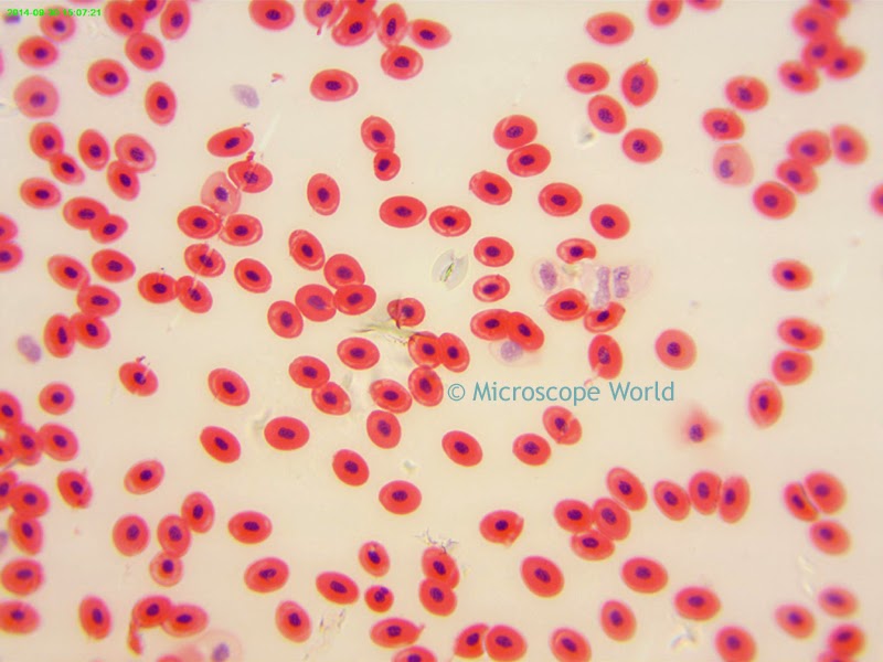 Student microscope image of frog's blood.