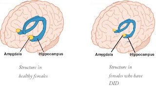 the causes effects and treatments of dissociative identity disorder What are the causes, risk factors and complications of dissociative identity disorder what are the causes of dissociative identity disorder to date, there has been no proven scientific. the causes effects and treatments of dissociative identity disorder What are the causes, risk factors and complications of dissociative identity disorder what are the causes of dissociative identity disorder to date, there has been no proven scientific.