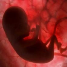 TROMBOFILIA SI SARCINA TROMBOFILIA SI SARCINA