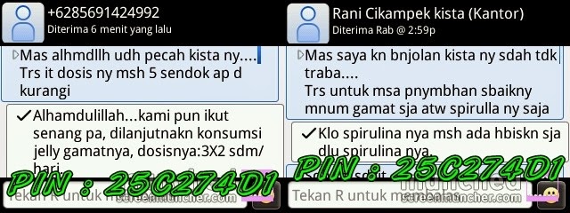 Testimoni Kista Bartholin Jelly Gamat Gold-G Testimoni Kista Bartholin Jelly Gamat Gold-G