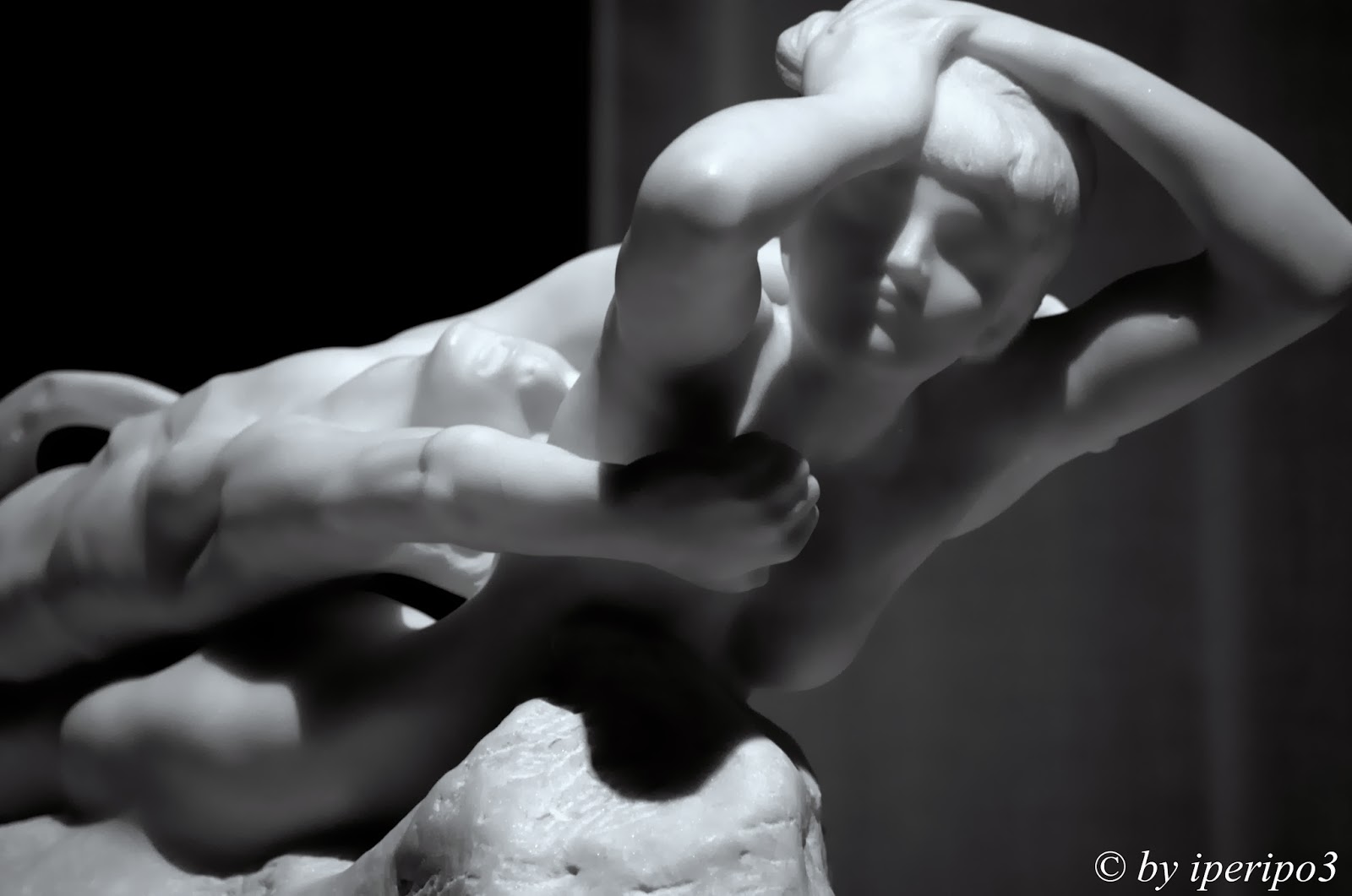 Dolore nella parte lasciata di un collo da tiroide