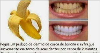 blanquear dientes en casa como blanquear los dientes en casa blanquear dientes en casa como blanquear los dientes en casa