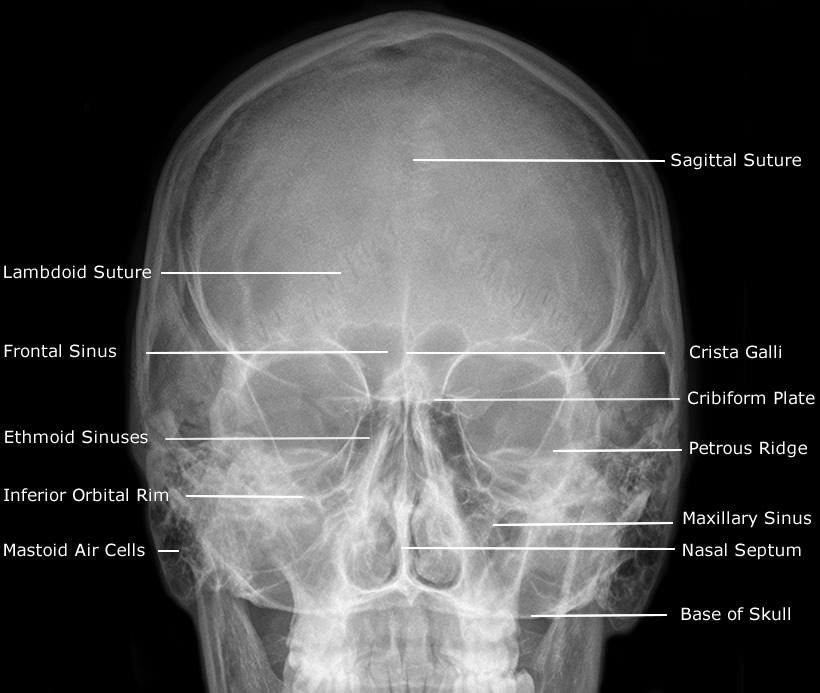 Facial Bone X Ray 22