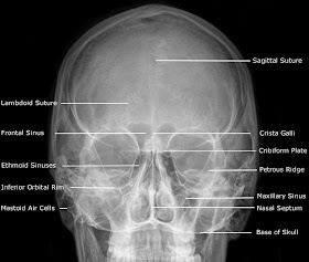 Adult+Facial+Bones+-+PA+Caldwell.jpg