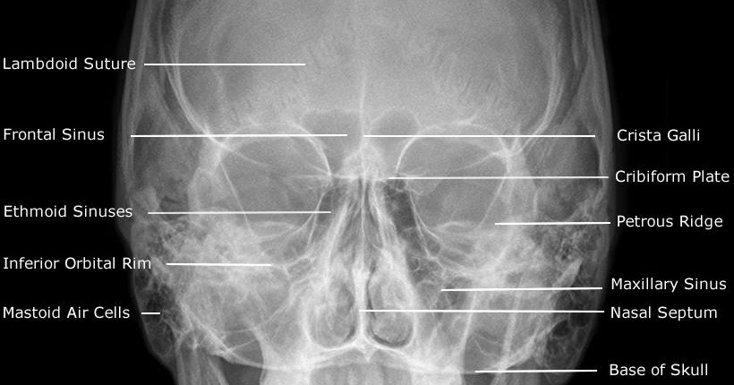 Dentistry lectures for MFDS/MJDF/NBDE/ORE: Radiographic ... cervical vertebrae diagram labeled 