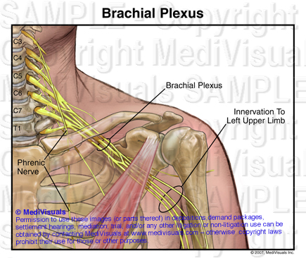 brachial plexus nerves