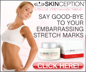 Skinception™ Intensive Stretch Mark Therapy Visibly Reduce The Appearance Of Stretch Marks