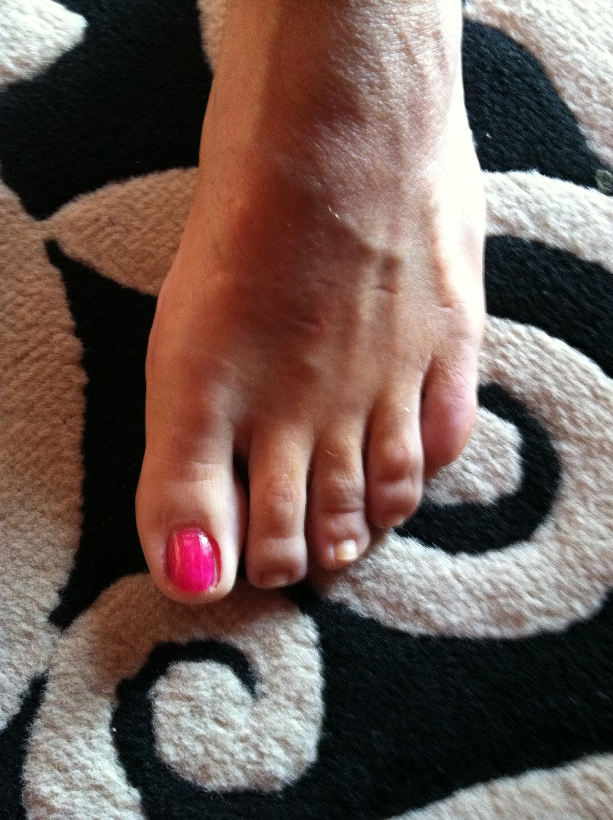 pink toenail
