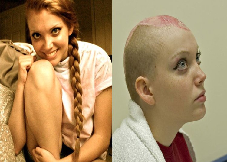 Long hair leads to woman scalped pictures Long hair leads to woman scalped pictures