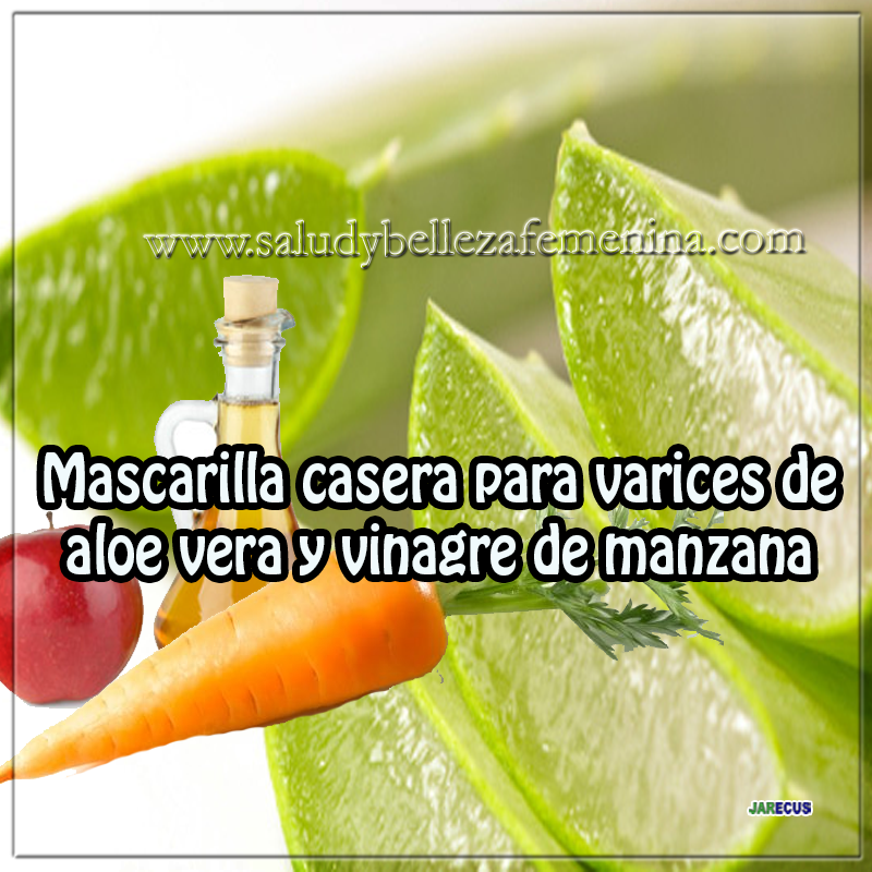 Mascarilla casera para varices de aloe vera y vinagre de manzana Mascarilla casera para varices de aloe vera y vinagre de manzana