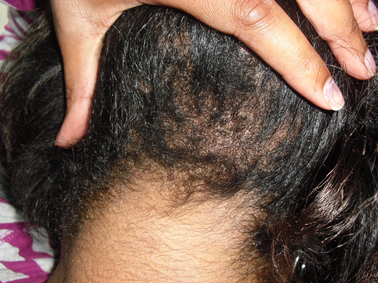 Chemical Burns Walmart Salons And Crappy Customer Service