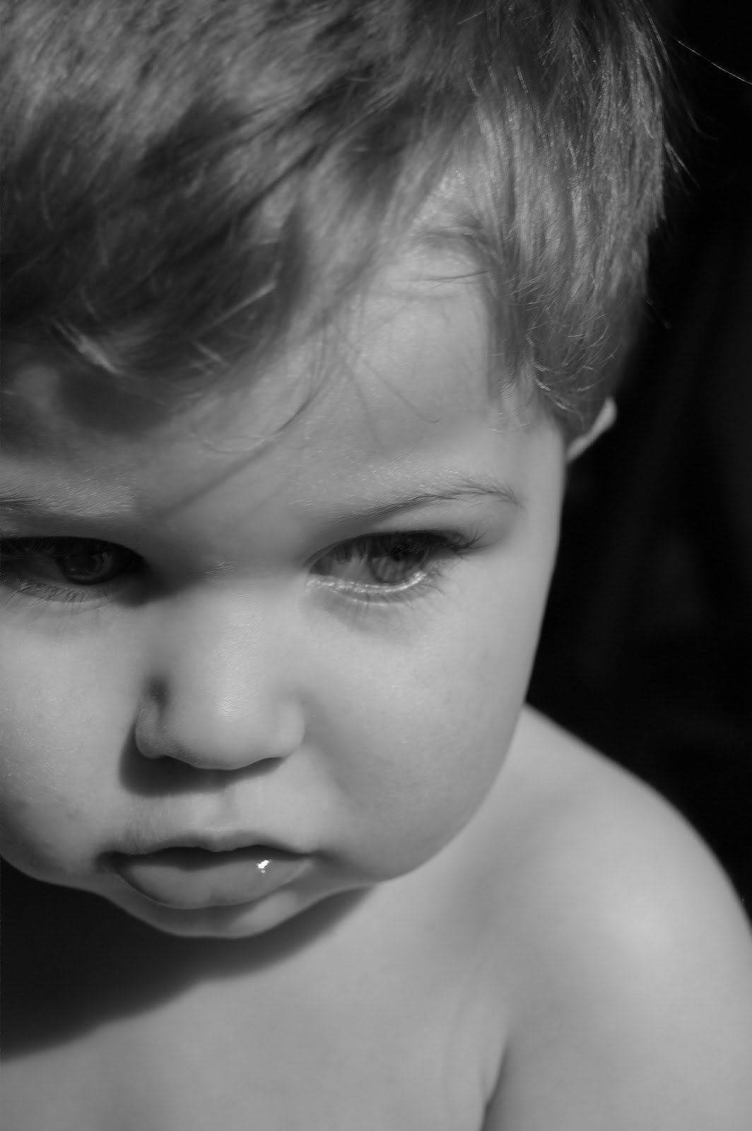 Ways to Eliminate Eczema The Pistachio Project